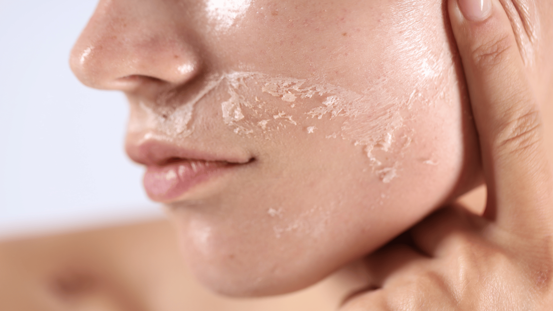 Dry January for your skin: why skin feels dry in winter