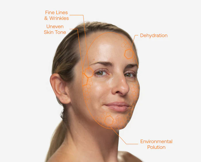 Woman's face with skin concerns highlighted on a white background