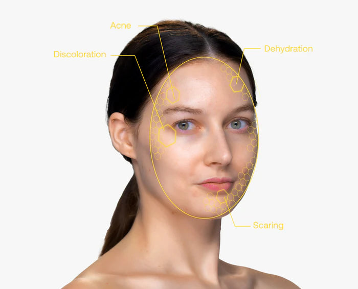 Woman's face with skin issues highlighted on a white background