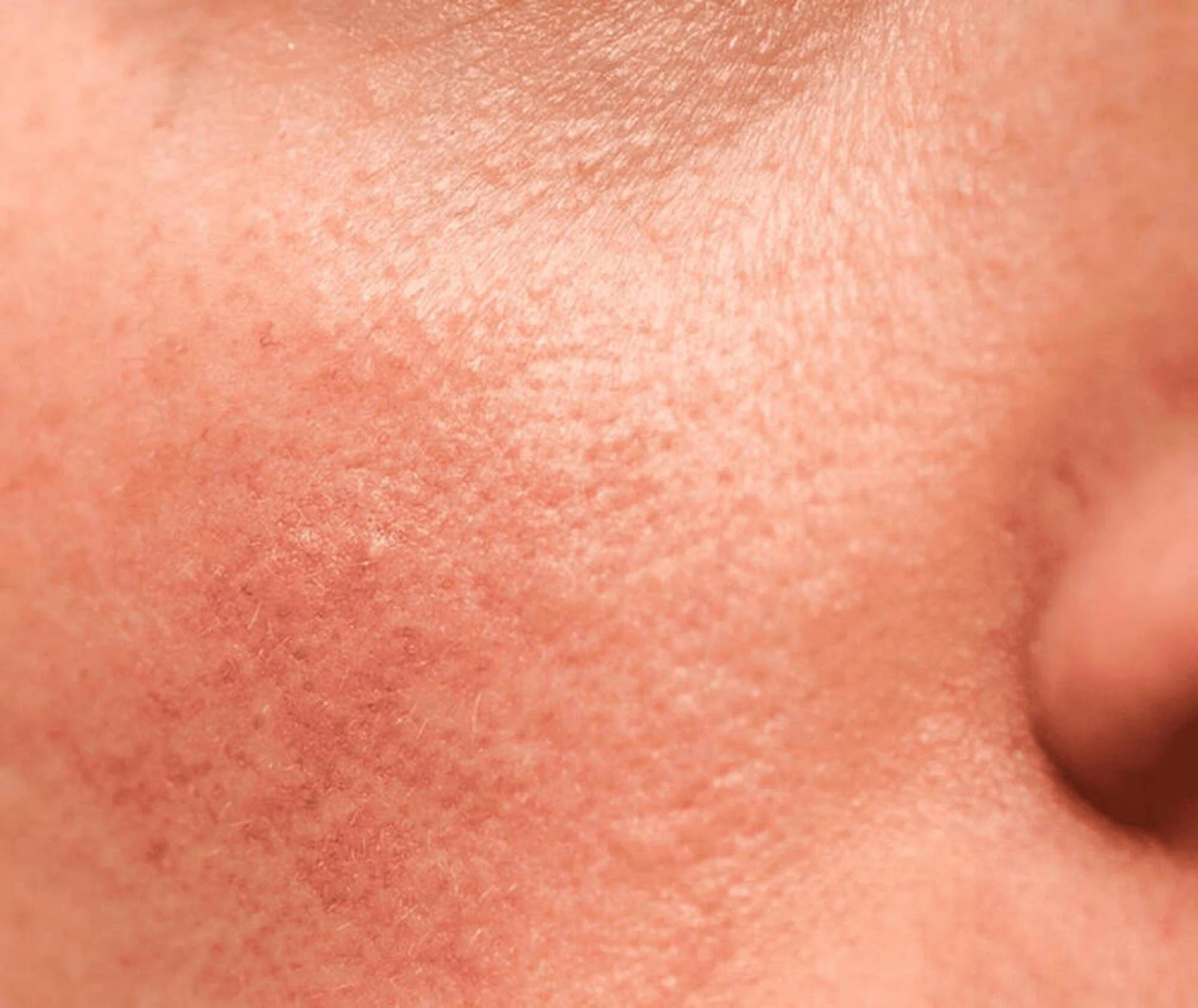 Close-up of human skin texture