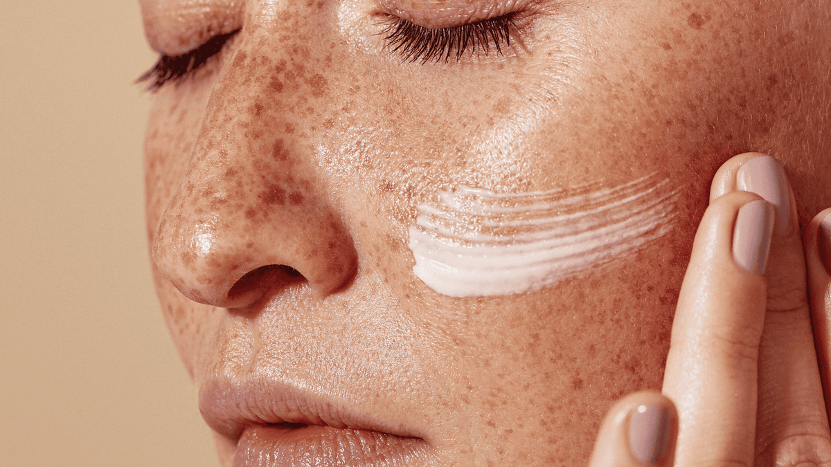 Why pigmentation appears in spring and how to prevent dark spots