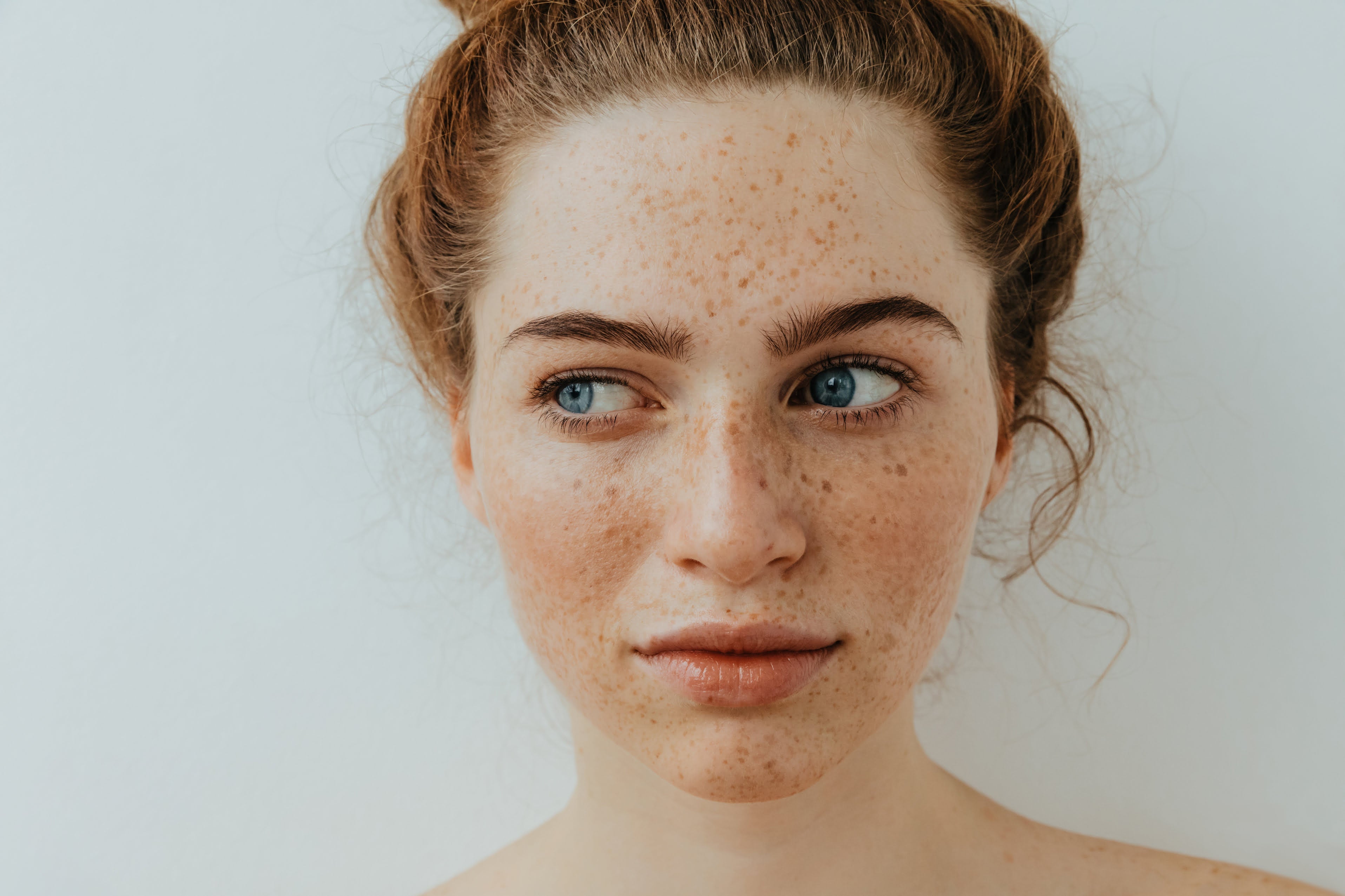 Hyperpigmentation & Dark Spots