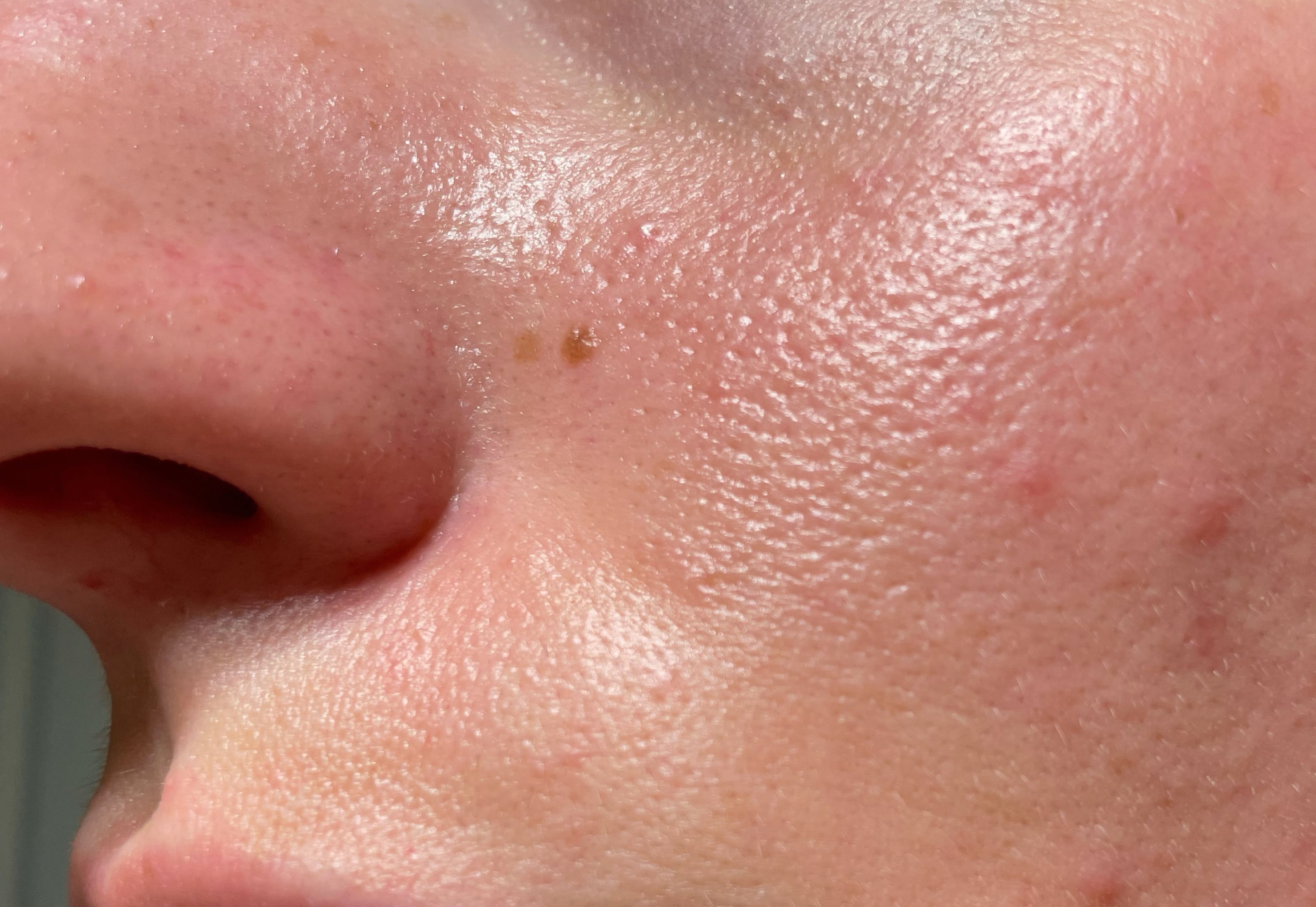 Visible Pores