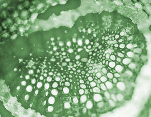 Microscopic view of plant cells under a microscope