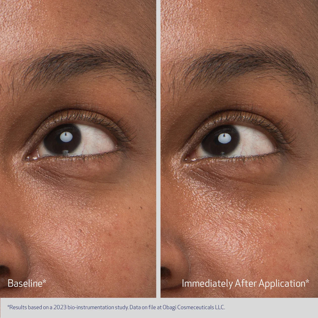 Before and after comparison of eye area treatment on a person's face.