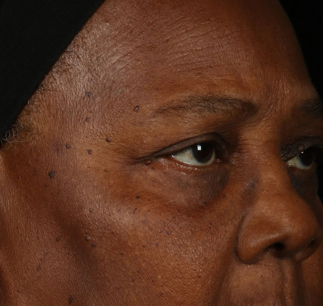 Close-up of a person's face with a dark background