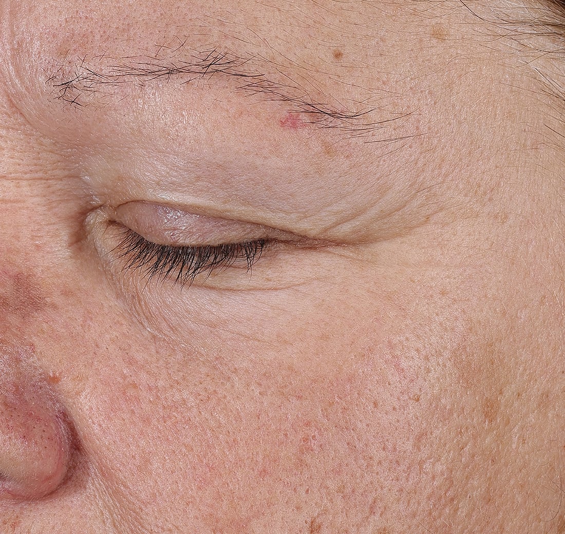 Close-up of a person's eye with visible skin texture and lines