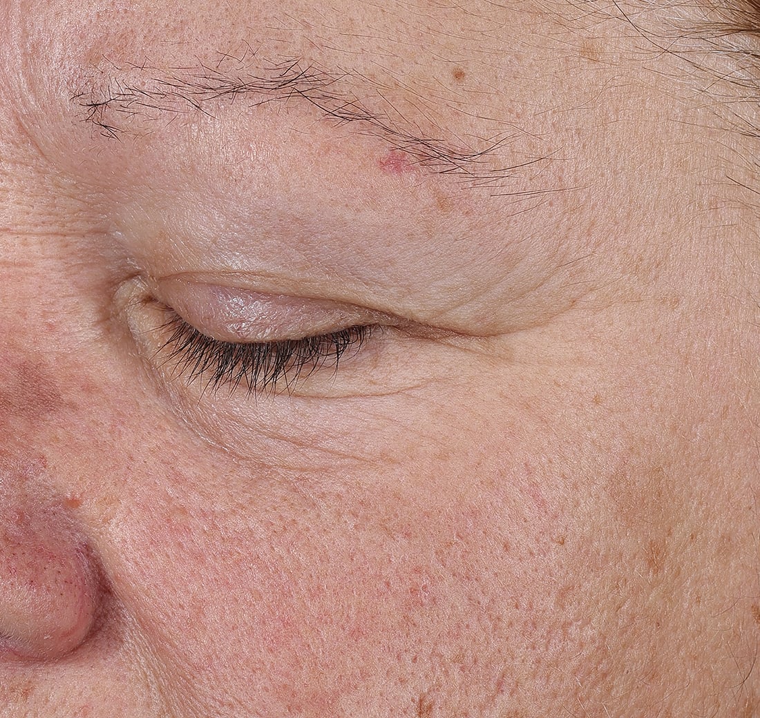 Close-up of a person's eye with visible wrinkles and skin texture