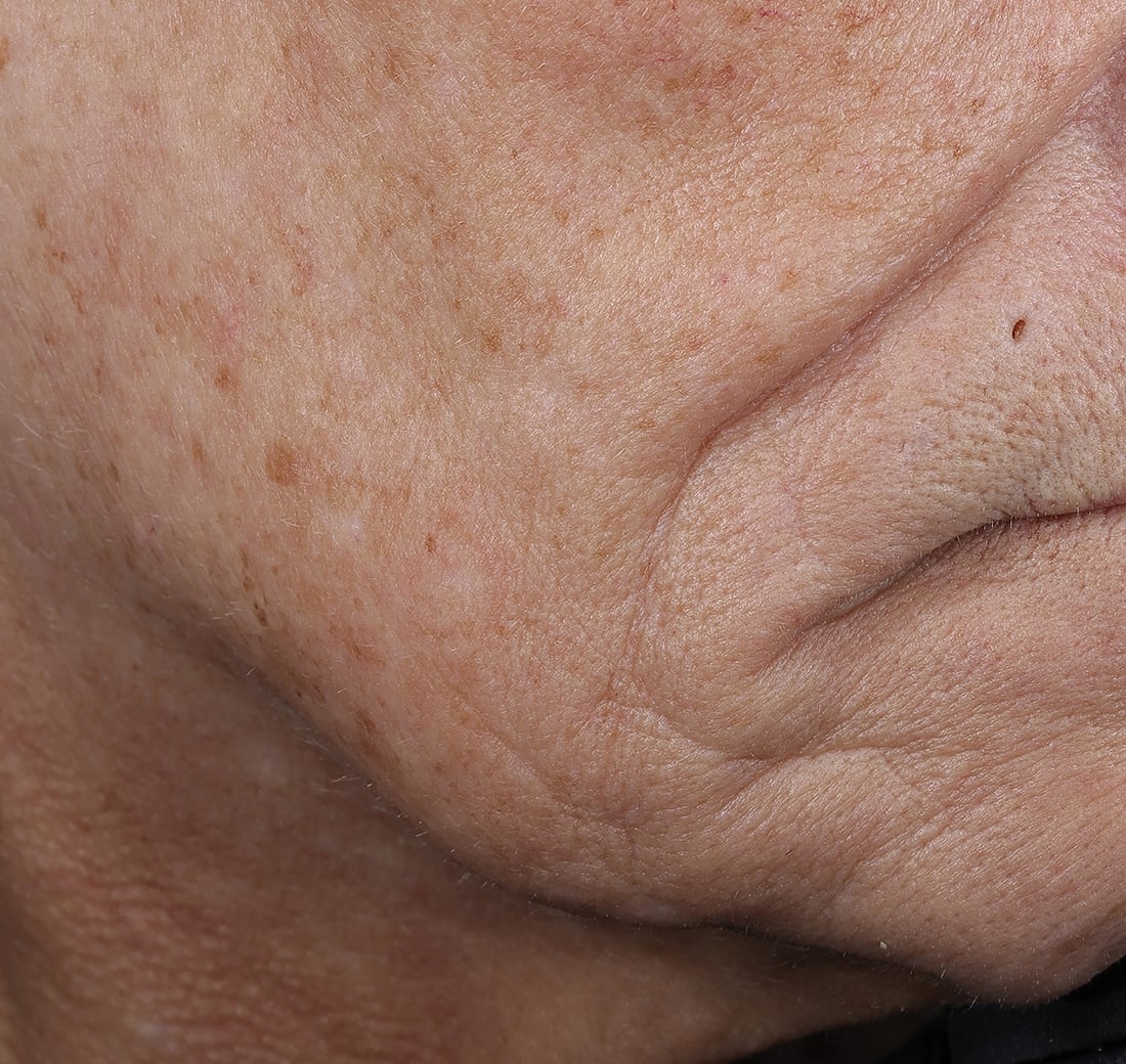 Close-up of a person's skin with visible wrinkles and texture