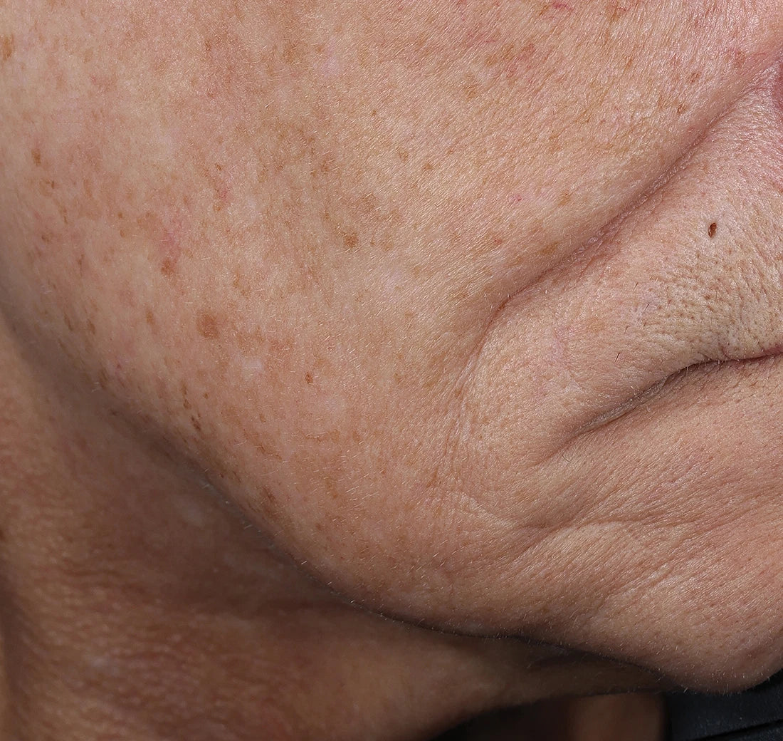 Close-up of a person's neck with visible skin texture and lines