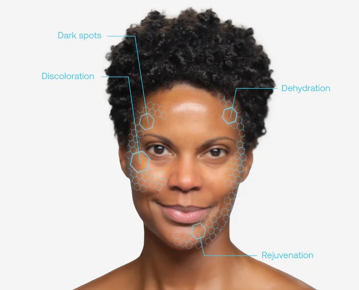 Woman's face with skin concerns labeled on a white background