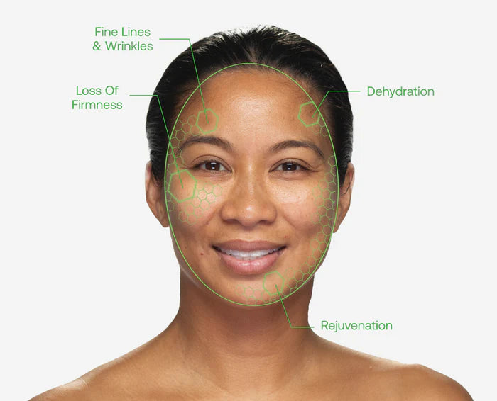 Woman's face with skin concerns highlighted on a white background