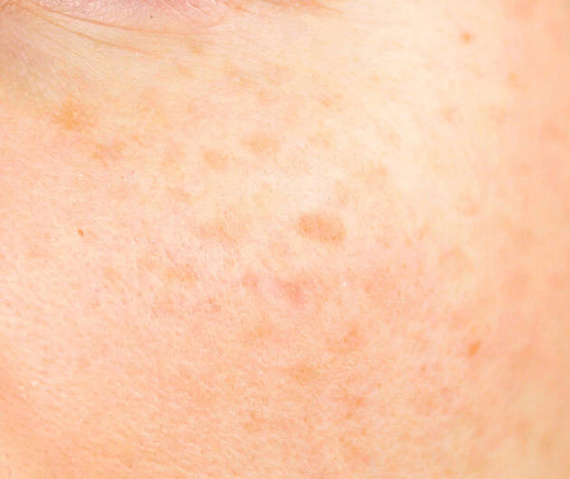 Close-up of human skin texture