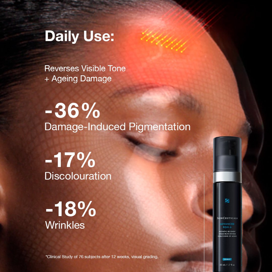skinceuticals advanced rgn 6 cream with claims of reversing visible tone and aging damage on a close-up of a person's face.